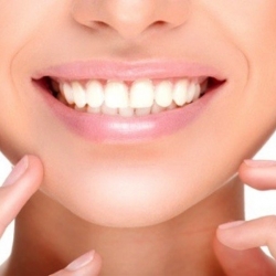 Teeth Whitening Options Explained