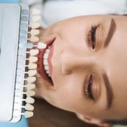 Benefits of Fixing Dental Veneers in Jacksonville